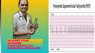 PAROXYMAL SUPERVENTRICULAR TRACHYCARDIA BY DRSUMIT TYAGISUMITMEDICALDISPENSARY1 [upl. by Conover899]