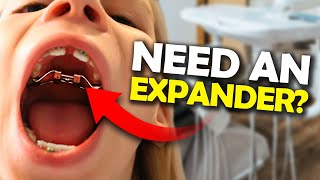 Getting a Palatal Expander What you NEED to know  McKinney Orthodontist [upl. by Serene]