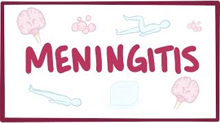 Meningitis  causes symptoms diagnosis treatment pathology [upl. by Rella294]