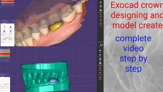 Exocad 30 Galway  How to Make ModelsMaking Models in ExocadExocad Model creatorexocad design [upl. by Asina]