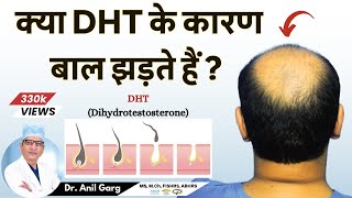 क्या DHT के कारण बाल झड़ते हैं  Do DHT Causes Hair Loss  Dr Anil Garg [upl. by Lahey874]