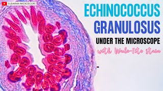 Echinococcus granulosus under the microscope with WadeFite stain [upl. by Lindo]