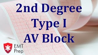 2nd Degree Type 1 AV Block ECG  EMTprepcom [upl. by Nallak]