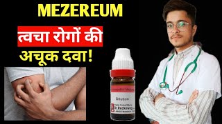 Mezereum 30 Homoeopathic Medicine uses in Hindi [upl. by Klara]