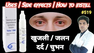 Tobramycin dexamethasone eye drops  Toba dm eye drops uses in hindi  Tobradex eye drops use [upl. by Sivaj]