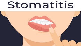 stomatitiscauses of stomatitissymptoms of stomatitisshort [upl. by Eusoj]