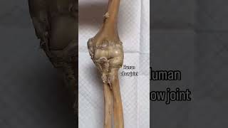 HUMAN ELBOW JOINT  Anatomy  Surgery  medical animation anatomy [upl. by Ewan818]