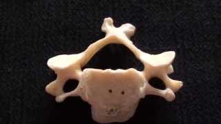 Cervical Vertebrae  Typical cervical vertebrae  Anatomy [upl. by Agnew]