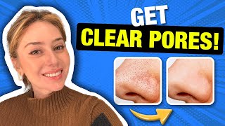 How to Get Clear Pores from a Dermatologist  Dr Shereene Idriss [upl. by Evadnee]