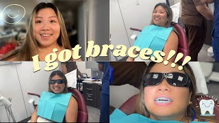 Getting braces vlog [upl. by Nakashima]