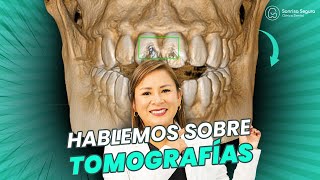 Tomografía Dental Tu Sonrisa en Alta Definición  Descubre su Importancia [upl. by Eitak]