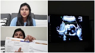 Mujhe pehle se kaise pata tha baby girl hone wali hai👶Wo kaun sa ultrasound h jaha gender Pta chalta [upl. by Nedia]