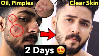 10 Pimple Mistakes  How to Remove Pimples From Face  Remove Acne Naturally [upl. by Isbel713]