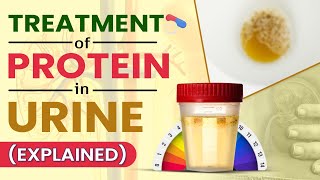 Treatment Of Protein In Urine Explained [upl. by Sou489]