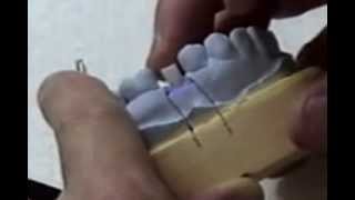 Custom Cast Dental Implant Abutment  Lab waxing procedure [upl. by Marcin]