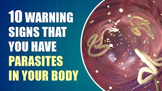 Dont Ignore These Early Symptoms of Parasites In Your Body [upl. by Dalis59]