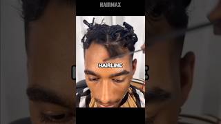 How to fix a Cowlick Hairline [upl. by Akayas]