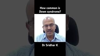 How common is Down syndrome Trisomy 21 downsyndrome [upl. by Rheta]