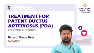 Treatment for Patent Ductus Arteriosus PDA  Preterm Birth  Placenta Previa  Yashoda Hospitals [upl. by Yborian295]