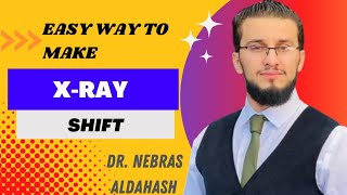 How to take xray with shift in easy way  DrNebras Aldahash [upl. by Everest]