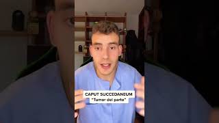 “Caput Succedaneum” shorts [upl. by Alorac762]