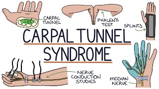 Carpal tunnel syndrome  causes symptoms diagnosis treatment amp pathology [upl. by Holtorf740]