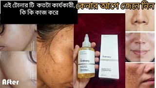 The Ordinary Glycolic acid 7 Exfoliating Toner কি কি কাজ করে থাকে এটা আমাদের স্কিন এর জন্য কতটা উ [upl. by Uah]