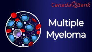 Multiple Myeloma [upl. by Ekrub]