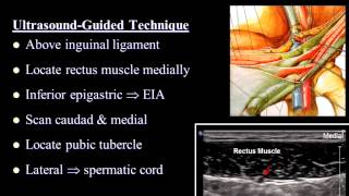 Pain Medicine  Ilioinguinal Nerve Iliohypogastric Nerve Inguinal Canal TAP [upl. by Wailoo]