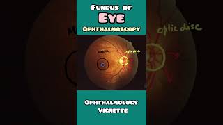 Fundus of an EYE explained simply in less than 60 seconds  USMLE NEET PG NCLEX [upl. by Nodnas897]