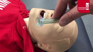 Nasopharyngeal Airway Insertion [upl. by Uzzial]