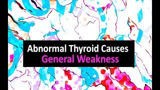 Abnormal Thyroid Causes General Weakness [upl. by Eindys]