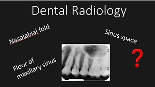 Dental Radiograph showing normal anatomy [upl. by Notslar495]