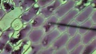 Onion Cells Plasmolysis [upl. by Tess]