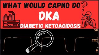 What would CAPNO do DKA [upl. by Marve]