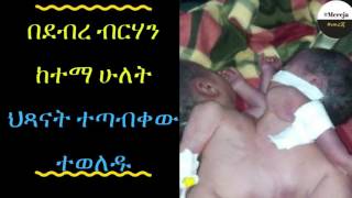 ETHIOPIA Parasitic twin born in north Shewa Debrebrhan City [upl. by Zellner]