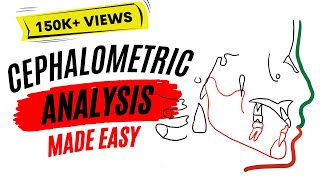 Cephalometric analysis [upl. by Keldon]