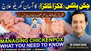 Chickenpox How to avoid it how to treat it and what to do if you get it chicken pox treatment [upl. by Dyana]