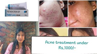 Tretinoin Me amp Acne Night Skin care acne treatment ✅ [upl. by Attelrahc]