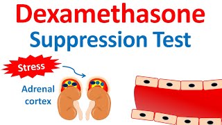 Dexamethasone suppression test DST  Cushings syndrome [upl. by Vasquez]