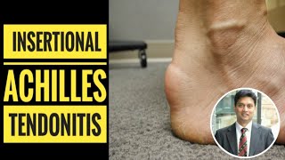 Insertional Achilles Tendinitis How to Diagnose [upl. by Imefulo]