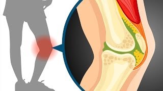 Sliding filament theory in muscle contraction  Wellcome [upl. by Ulphiah841]