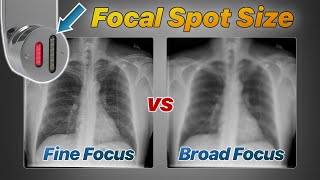 Focal Spot Size Explained Fine vs Broad Focus [upl. by Peria]