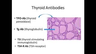 2016 Interpreting Abnormal Thyroid Function Tests amp Understanding Indications for Treatment [upl. by Silrak]