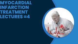 MYOCARDIAL INFARCTION MANAGEMENT HEART ATTACK TREATMENT [upl. by Rothmuller485]