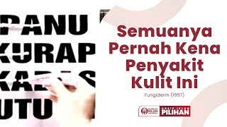 Semuanya Pernah  Iklan Fungiderm 1997 [upl. by Moersch]