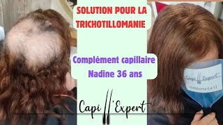 La solution idéale pour le manque de cheveux chez la femme  Complément Capillaire  explication [upl. by Nicki]