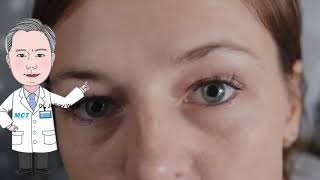 Are you overusing eye drops for dry eye？ [upl. by Gulgee682]