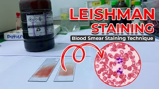 LEISHMAN STAINING  Blood Smear Staining Technique  Heamatology [upl. by Erlond]