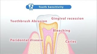 Relieve tooth sensitivity with Teethmate Desensitizer Creating Hydroxyapatite HAp [upl. by Airekat]